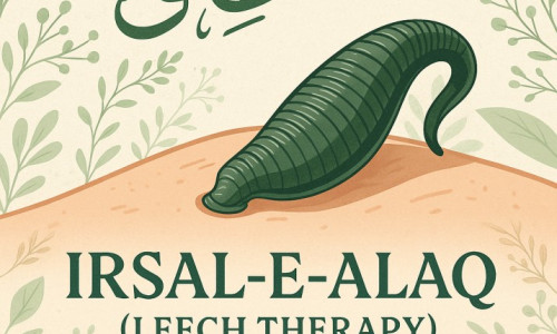 Irsal-e-Alaq (Leech Therapy) in Unani Medicine Irsal-e-Alaq (Leech Therapy) in Unani Medicine